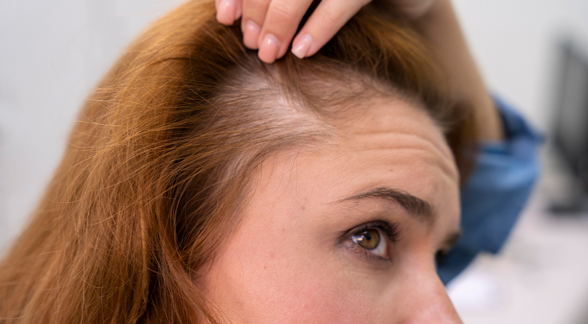 What to Do When Your Find a Bald Spot